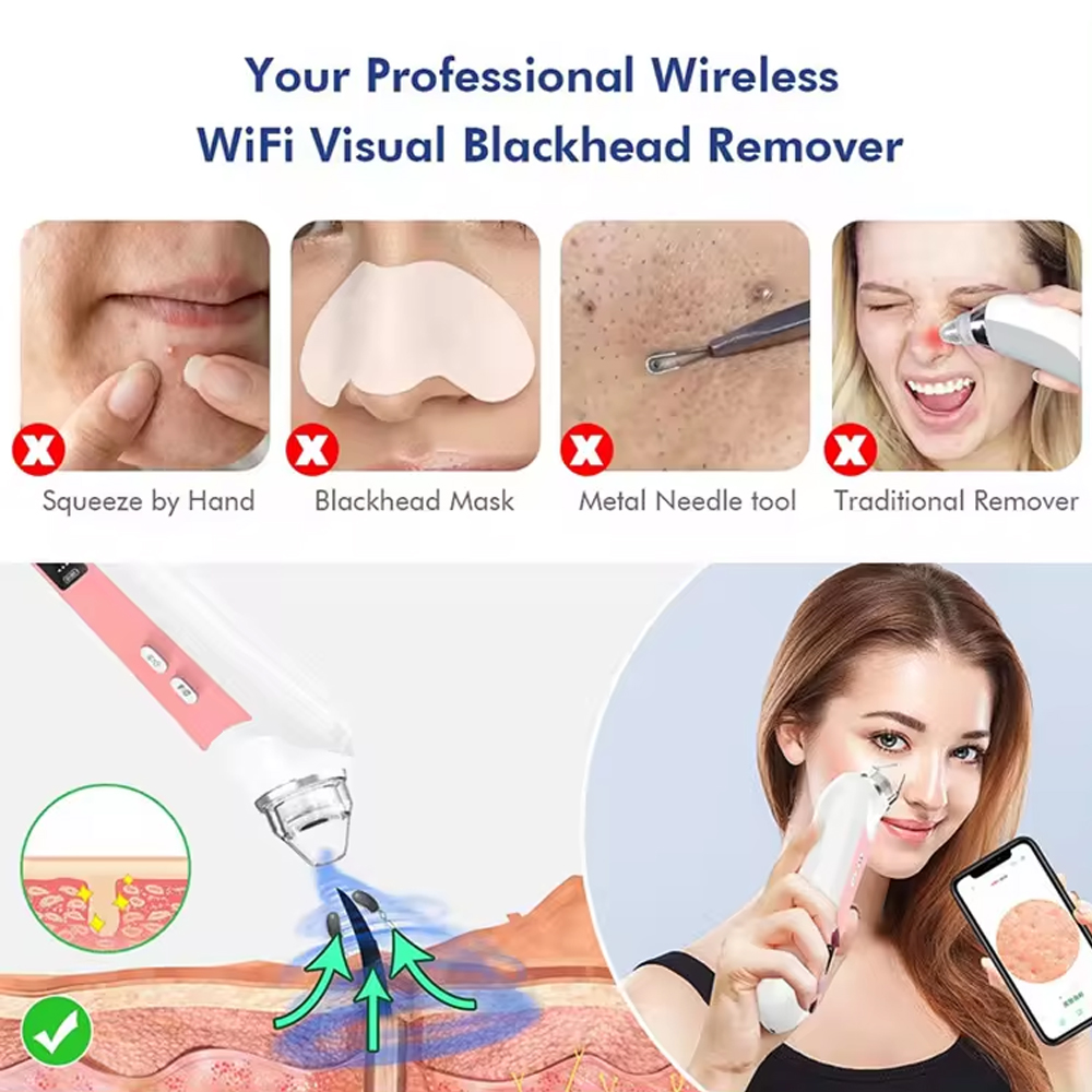 เครื่องดูดกำจัดสิวหัวดำ6เครื่อ - Nasal Aspirator บทวิจารณ์และราคา
